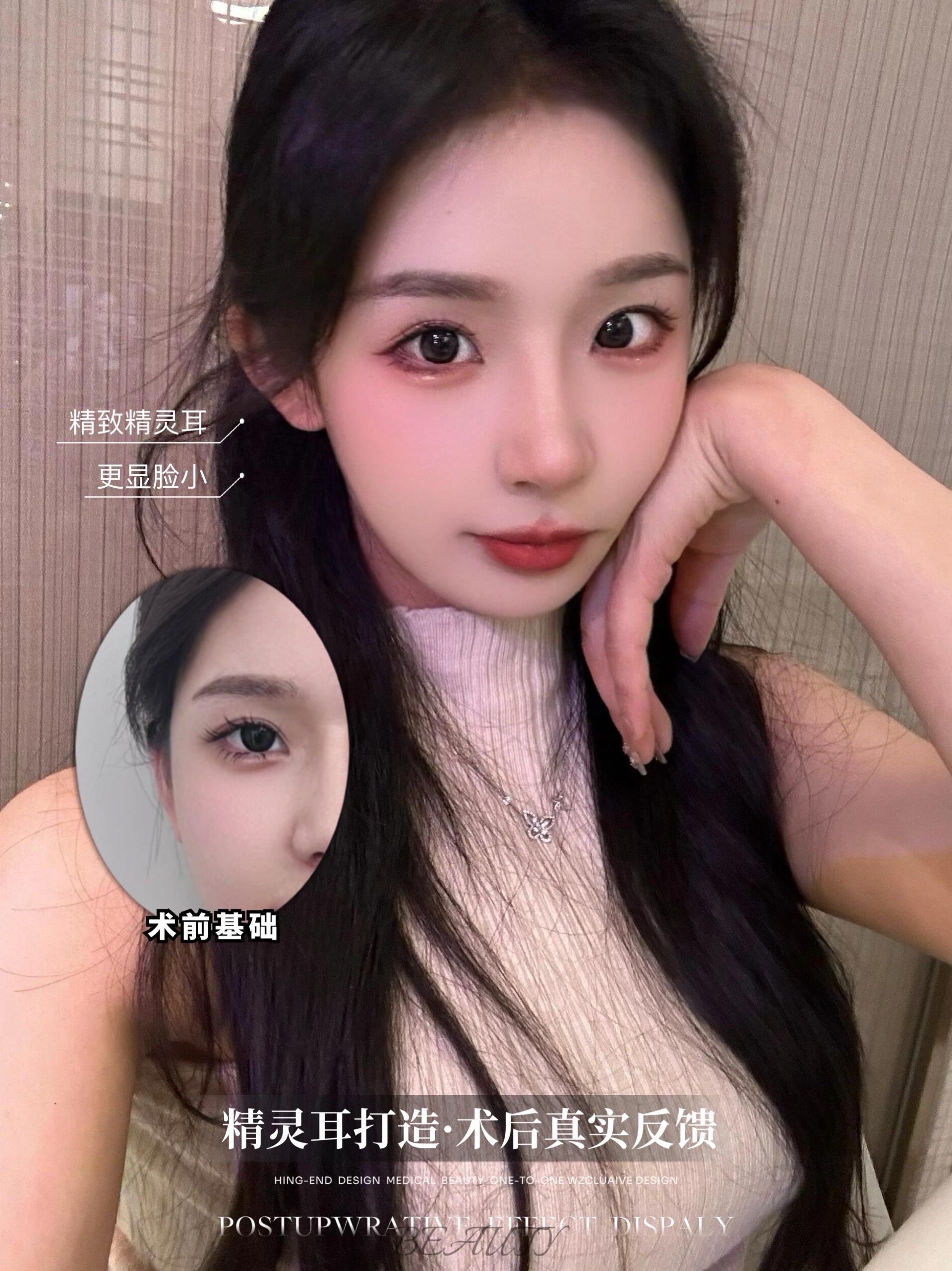 要打造出这样的幼态脸，具体需要做哪些医美项目呢
